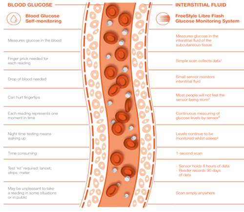 Diagram showing the difference between blood glucose and interstitial glucose